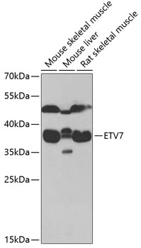 Western blot - ETV7 Polyclonal Antibody 