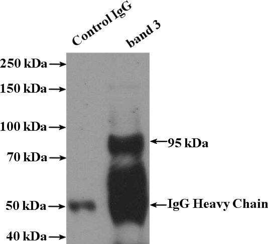 IP Result of anti-SLC4A1 (IP:Catalog No:108417, 4ug; Detection:Catalog No:108417 1:300) with mouse liver tissue lysate 4000ug.