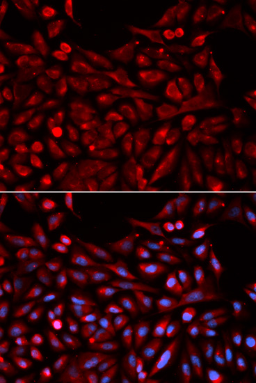 Immunofluorescence - NR1I3 Polyclonal Antibody 