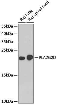 Western blot - PLA2G2D Polyclonal Antibody 