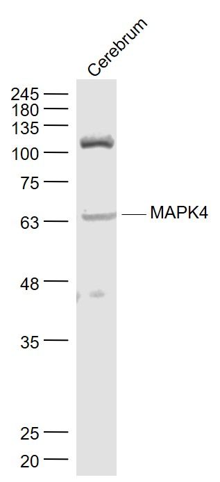 Fig1: Sample:; Cerebrum (Mouse) Lysate at 40 ug; Primary: Anti- MAPK4 at 1/1000 dilution; Secondary: IRDye800CW Goat Anti-Rabbit IgG at 1/20000 dilution; Predicted band size: 66 kD; Observed band size: 66 kD