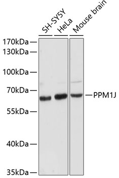 Western blot - PPM1J Polyclonal Antibody 