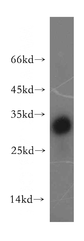 mouse thymus tissue were subjected to SDS PAGE followed by western blot with Catalog No:116350(TRAT1 antibody) at dilution of 1:500