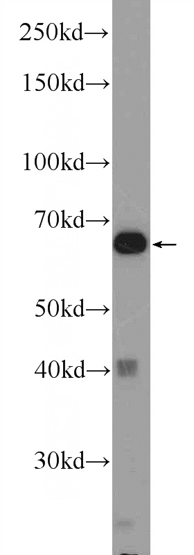 mouse skeletal muscle tissue were subjected to SDS PAGE followed by western blot with Catalog No:110301(EDEM2 Antibody) at dilution of 1:300
