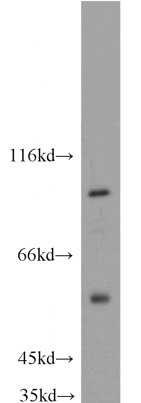 mouse brain tissue were subjected to SDS PAGE followed by western blot with Catalog No:112424(MAP4K2 antibody) at dilution of 1:300