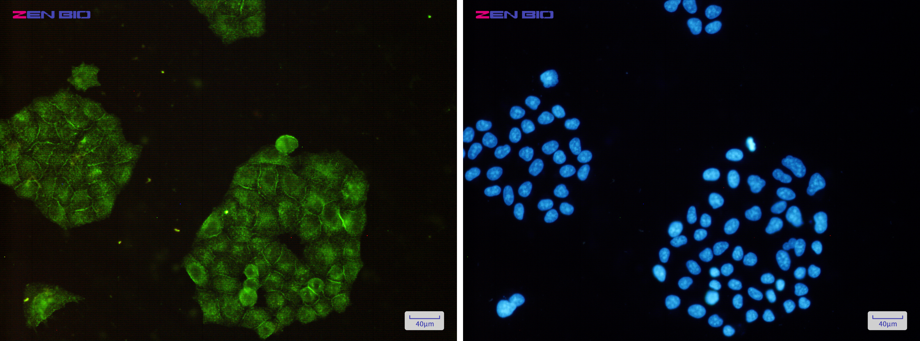 Immunocytochemistry of ARPC2(green) in Hela cells using ARPC2 Rabbit pAb at dilution 1/50, and DAPI(blue)
