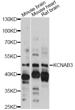 Western blot - KCNAB3 Polyclonal Antibody 