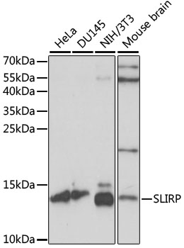 Western blot - SLIRP Polyclonal Antibody 