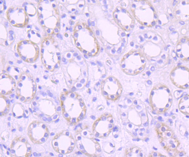 Fig4:; Immunohistochemical analysis of paraffin-embedded human kidney tissue using anti-PDK1 antibody. The section was pre-treated using heat mediated antigen retrieval with Tris-EDTA buffer (pH 8.0-8.4) for 20 minutes.The tissues were blocked in 5% BSA for 30 minutes at room temperature, washed with ddH; 2; O and PBS, and then probed with the primary antibody ( 1/50) for 30 minutes at room temperature. The detection was performed using an HRP conjugated compact polymer system. DAB was used as the chromogen. Tissues were counterstained with hematoxylin and mounted with DPX.