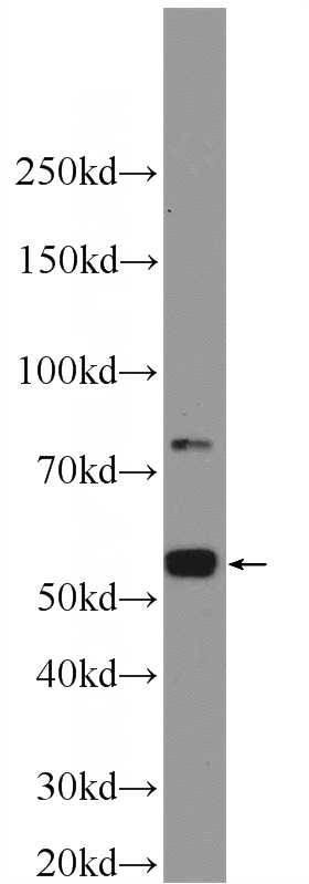 mouse testis tissue were subjected to SDS PAGE followed by western blot with Catalog No:115938(TEKT3 antibody) at dilution of 1:1000