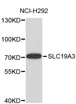 Western blot - SLC19A3 Polyclonal Antibody 