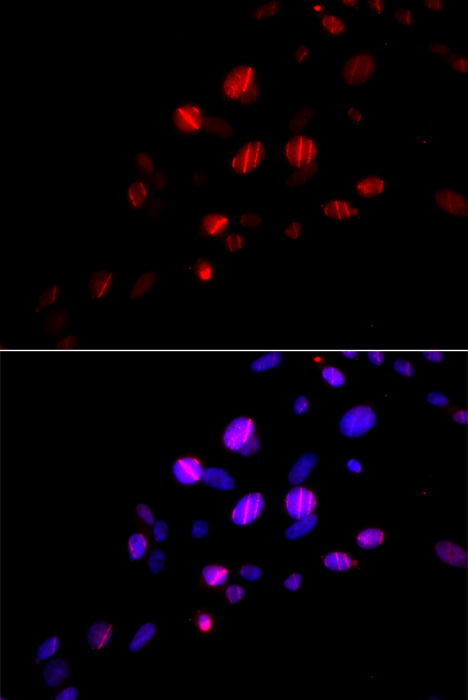 Immunofluorescence - RAD18 Polyclonal Antibody 