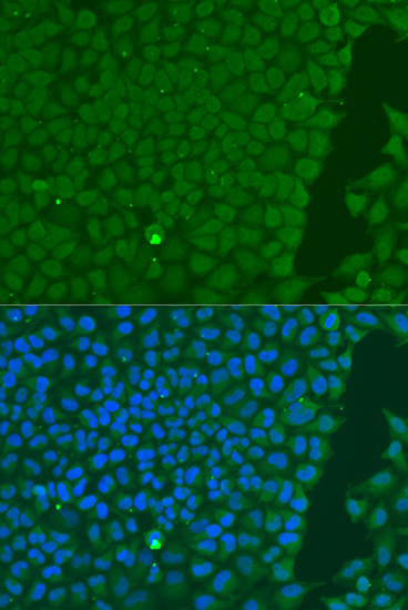 Immunofluorescence - CD31 Polyclonal Antibody 