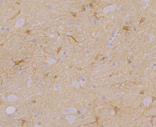 Fig3: Immunohistochemical analysis of paraffin-embedded rat brain tissue using anti-CACNG3 antibody. Counter stained with hematoxylin.