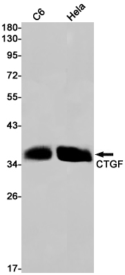 Western blot detection of CTGF in C6,Hela cell lysates using CTGF Rabbit pAb(1:1000 diluted).Predicted band size:38kDa.Observed band size:35kDa.