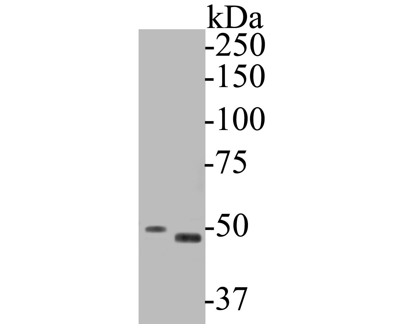 Fig1: Western blot analysis of Gasdermin D on different lysates. Proteins were transferred to a PVDF membrane and blocked with 5% BSA in PBS for 1 hour at room temperature. The primary antibody ( 1/500) was used in 5% BSA at room temperature for 2 hours. Goat Anti-Rabbit IgG - HRP Secondary Antibody (HA1001) at 1:5,000 dilution was used for 1 hour at room temperature.; Positive control:; Lane 1: SiHa cell lysate; Lane 2: human kidney tissue lysate