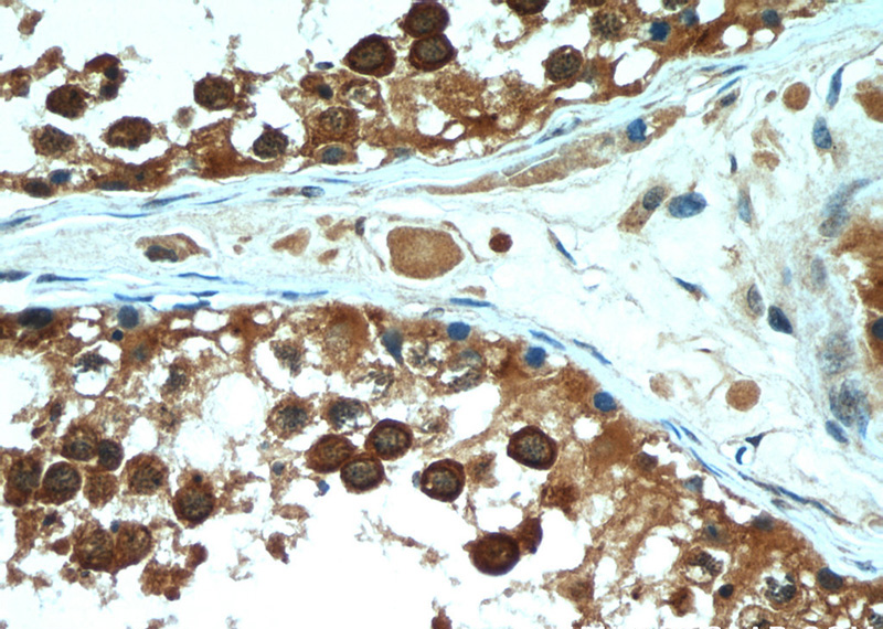 Immunohistochemical of paraffin-embedded human testis using Catalog No:113778(PGAP1 antibody) at dilution of 1:50 (under 40x lens)