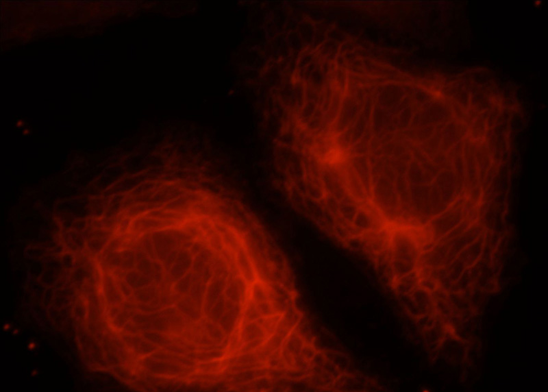 Immunofluorescent analysis of HepG2 cells, using KANK2 antibody Catalog No:111909 at 1:25 dilution and Rhodamine-labeled goat anti-rabbit IgG (red).