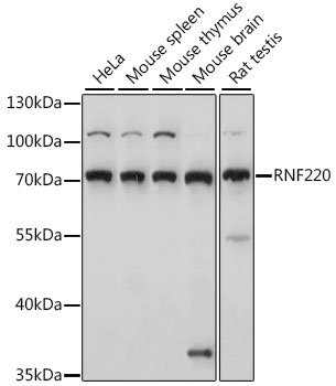 Western blot - RNF220 Polyclonal Antibody 