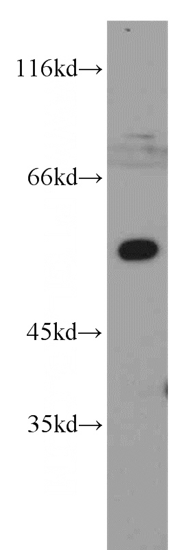 K-562 cells were subjected to SDS PAGE followed by western blot with Catalog No:115964(MAP3K7IP1 antibody) at dilution of 1:600