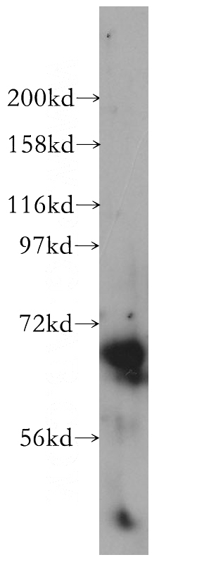 mouse spleen tissue were subjected to SDS PAGE followed by western blot with Catalog No:109301(CHSY1 antibody) at dilution of 1:500