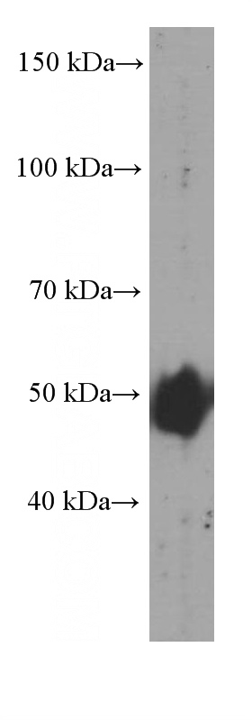 human adipose tissue were subjected to SDS PAGE followed by western blot with Catalog No:107560(ADRP Antibody) at dilution of 1:1000