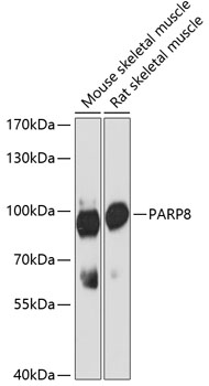 Western blot - PARP8 Polyclonal Antibody 