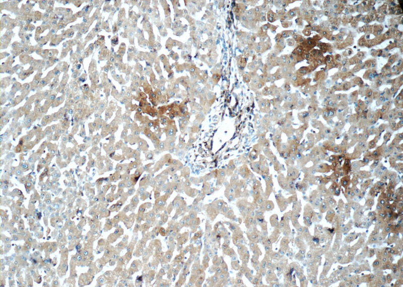 Immunohistochemistry of paraffin-embedded human liver tissue slide using Catalog No:109213(CHCHD3 Antibody) at dilution of 1:50 (under 10x lens)