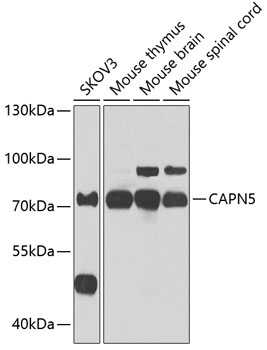 Western blot - CAPN5 Polyclonal Antibody 