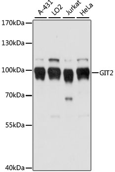 Western blot - GIT2 Polyclonal Antibody 