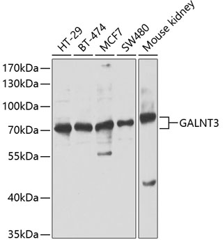 Western blot - GALNT3 Polyclonal Antibody 