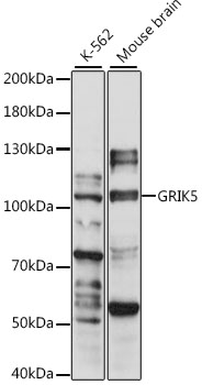 Western blot - GRIK5 Polyclonal Antibody 