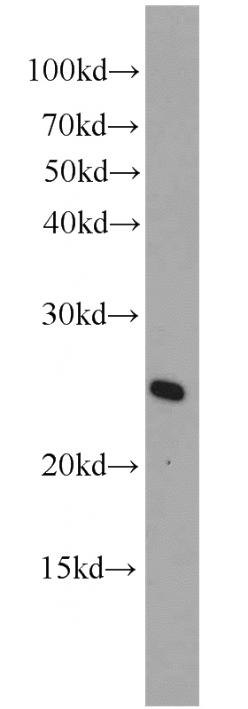 mouse liver tissue were subjected to SDS PAGE followed by western blot with Catalog No:108201(ARL4A antibody) at dilution of 1:500