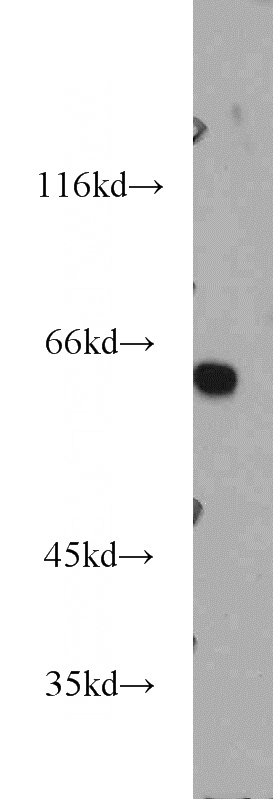 Jurkat cells were subjected to SDS PAGE followed by western blot with Catalog No:107843(AHCYL1 antibody) at dilution of 1:1000