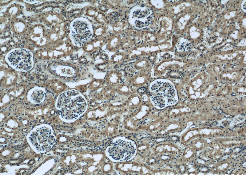 Immunohistochemical of paraffin-embedded human kidney using Catalog No:107528(APCS antibody) at dilution of 1:50 (under 10x lens)