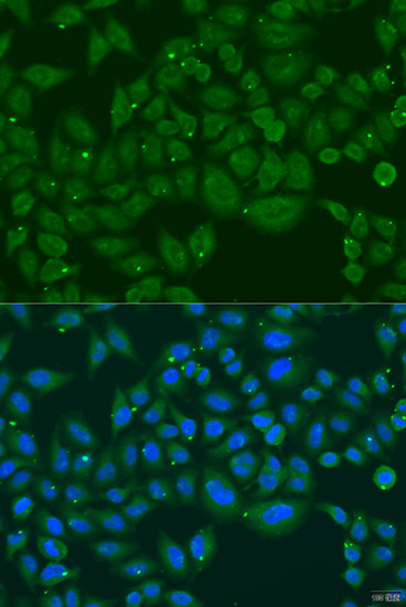 Immunofluorescence - INPP5K Polyclonal Antibody 
