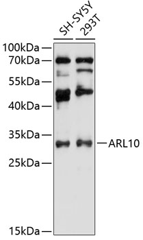 Western blot - ARL10 Polyclonal Antibody 