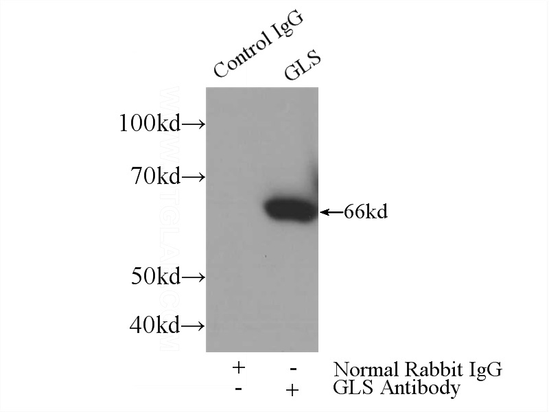IP Result of anti-GLS (IP:Catalog No:112035, 3ug; Detection:Catalog No:112035 1:800) with HEK-293 cells lysate 3200ug.