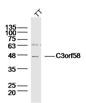 Fig1: Sample: TT(human) Cell Lysate at 40 ug; Primary: Anti-C3orf58 at 1/300 dilution; Secondary: IRDye800CW Goat Anti-Rabbit IgG at 1/20000 dilution; Predicted band size: 49 kD; Observed band size: 48 kD