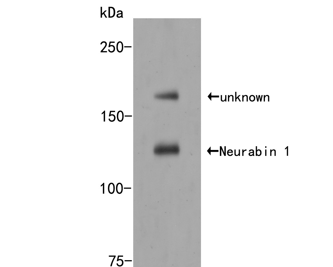 Anti-PPP1R9A antibody