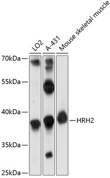 Western blot - HRH2 Polyclonal Antibody 