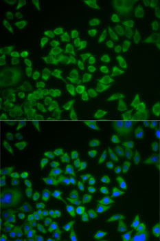 Immunofluorescence - ST14 Polyclonal Antibody 