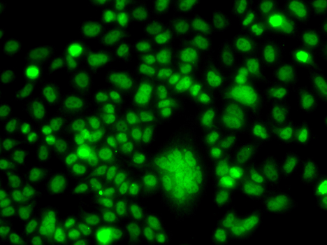 Immunofluorescence - PPAN Polyclonal Antibody 
