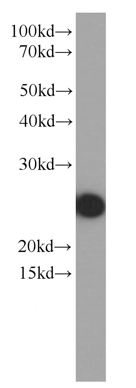 human plasma tissue were subjected to SDS PAGE followed by western blot with Catalog No:107061(APOA1 Antibody) at dilution of 1:2000