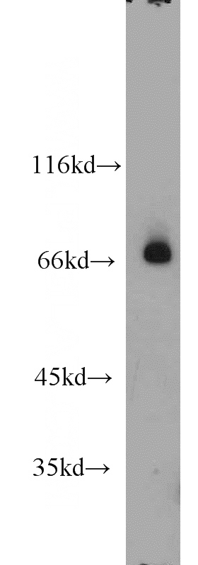 mouse liver tissue were subjected to SDS PAGE followed by western blot with Catalog No:114788(RORA antibody) at dilution of 1:1000