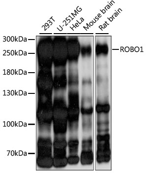 Western blot - ROBO1 Polyclonal Antibody 