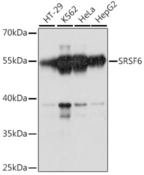 Western blot - SRSF6 Polyclonal Antibody 