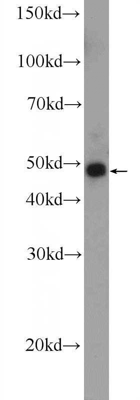 mouse brain tissue were subjected to SDS PAGE followed by western blot with Catalog No:111893(JNK2 Antibody) at dilution of 1:300
