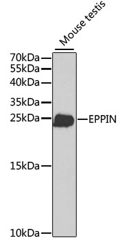 Western blot - EPPIN Polyclonal Antibody 