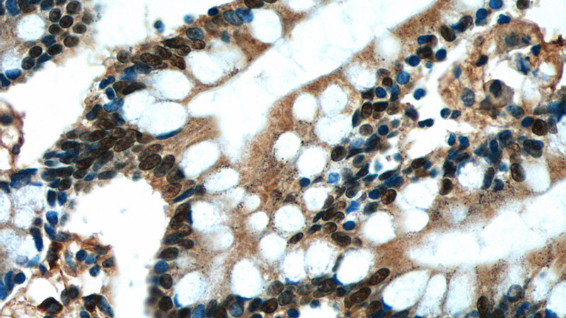 Immunohistochemistry of paraffin-embedded human small intestine tissue slide using Catalog No:111497(HNF4G Antibody) at dilution of 1:50 (under 40x lens)